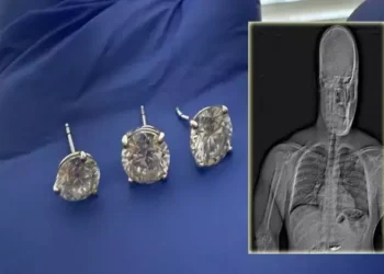 Cercei de 769.000 de dolari recuperați din stomacul unui hoț