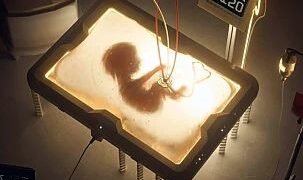 Japonia dezvoltă uterul artificial: o revoluție în îngrijirea neonatală și un posibil nou început pentru naștere