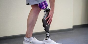 Un medic și-a amputat picioarele pentru banii de asigurări