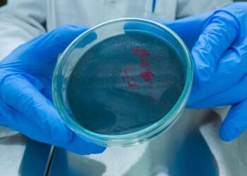 O româncă a murit de antrax