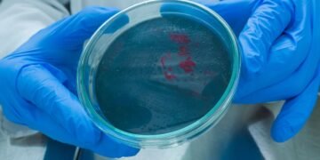 O româncă a murit de antrax