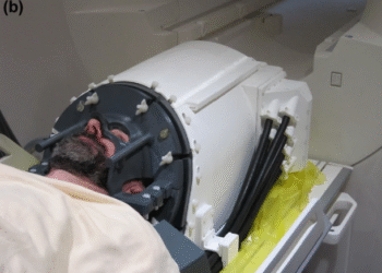 Casca cu ultrasunete ar putea revoluționa tratamentul bolii Parkinson