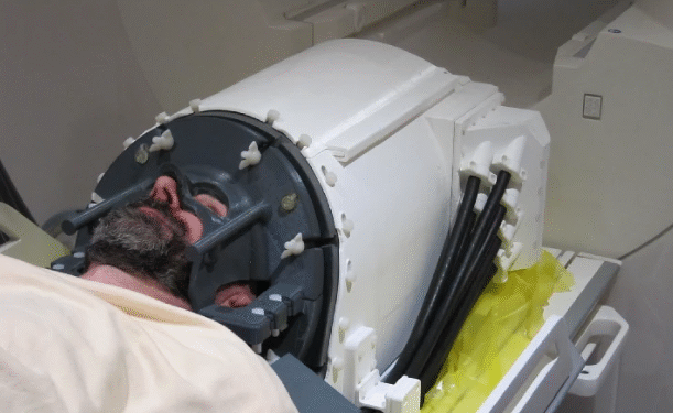 Casca cu ultrasunete ar putea revoluționa tratamentul bolii Parkinson