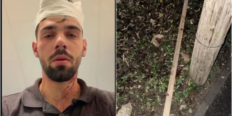 Tânăr bătut crunt de 8 fotbalişti