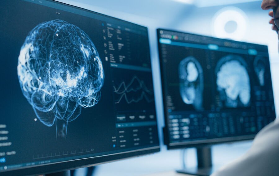 Descoperire medicală importantă: bolile cerebrale ar putea fi depistate timpuriu printr-un simplu test de salivă