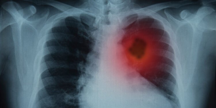 Un bărbat din Motru a primit o veste mai tristă decât condamnarea